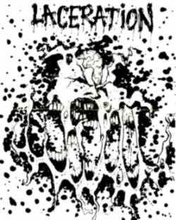 Laceration (USA-4) : Scabs